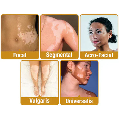 Revitalizing Bee Venom Cream – Natural Skin Restoration & Vitality 20g